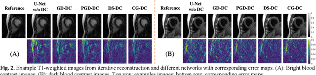 Figure 3 for Data-Consistent Non-Cartesian Deep Subspace Learning for Efficient Dynamic MR Image Reconstruction