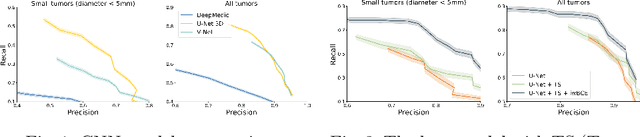 Figure 1 for Deep Learning for Brain Tumor Segmentation in Radiosurgery: Prospective Clinical Evaluation