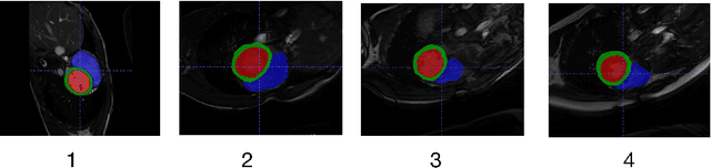Figure 4 for Semi-Supervised Domain Generalization for Cardiac Magnetic Resonance Image Segmentation with High Quality Pseudo Labels