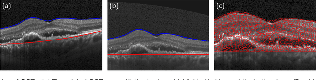 Figure 1 for Unsupervised Identification of Disease Marker Candidates in Retinal OCT Imaging Data