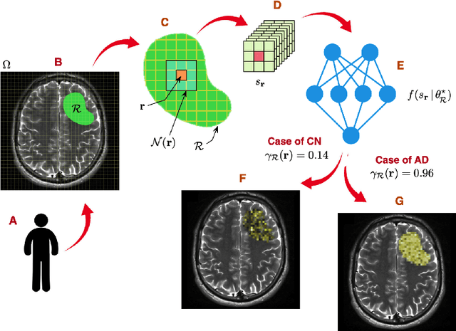 Figure 1 for Towards a quantitative assessment of neurodegeneration in Alzheimer's disease