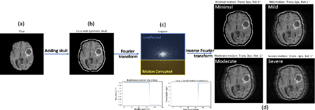 Figure 3 for Assessing Lesion Segmentation Bias of Neural Networks on Motion Corrupted Brain MRI