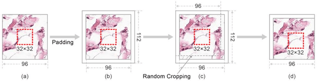 Figure 3 for Boosted EfficientNet: Detection of Lymph Node Metastases in Breast Cancer Using Convolutional Neural Network