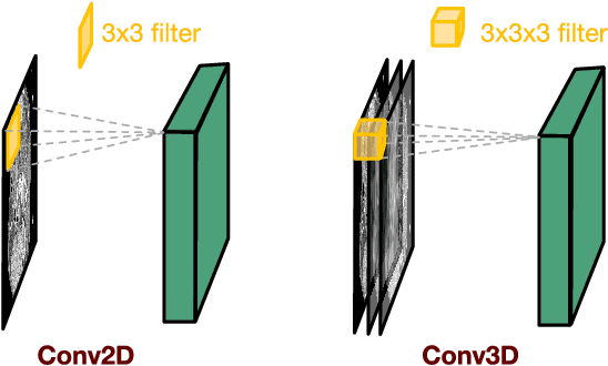 Figure 2 for 3D Convolutional Encoder-Decoder Network for Low-Dose CT via Transfer Learning from a 2D Trained Network