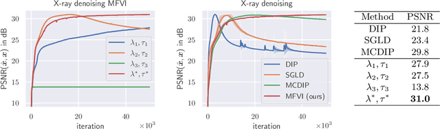 Figure 3 for Cold Posteriors Improve Bayesian Medical Image Post-Processing