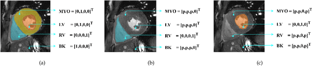 Figure 3 for Deep Compatible Learning for Partially-Supervised Medical Image Segmentation