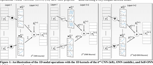 Figure 1 for Real-Time Patient-Specific ECG Classification by 1D Self-Operational Neural Networks