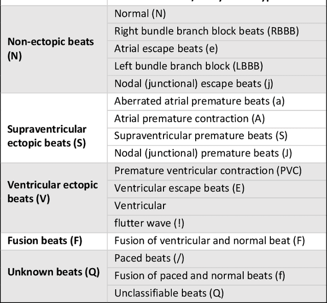 Figure 3 for Real-Time Patient-Specific ECG Classification by 1D Self-Operational Neural Networks