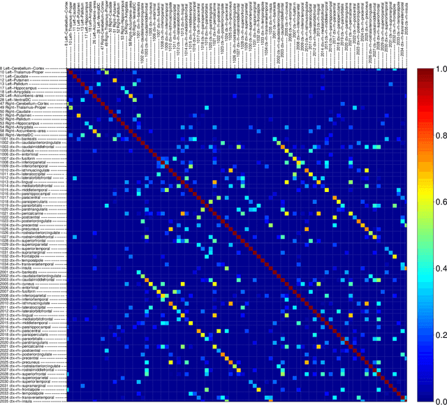 Figure 4 for Large Spectral Density Matrix Estimation by Thresholding