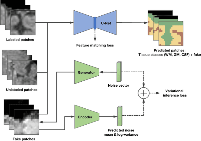 Figure 1 for Few-shot 3D Multi-modal Medical Image Segmentation using Generative Adversarial Learning