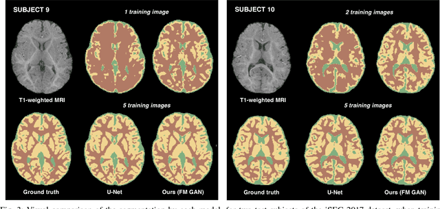 Figure 3 for Few-shot 3D Multi-modal Medical Image Segmentation using Generative Adversarial Learning