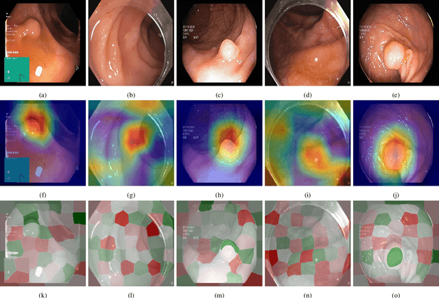 Figure 2 for Visual explanations for polyp detection: How medical doctors assess intrinsic versus extrinsic explanations