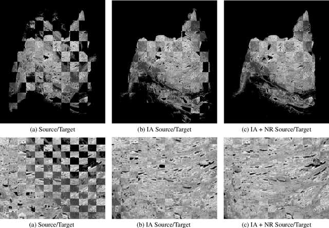 Figure 1 for Automatic Nonrigid Histological Image Registration with Adaptive Multistep Algorithm