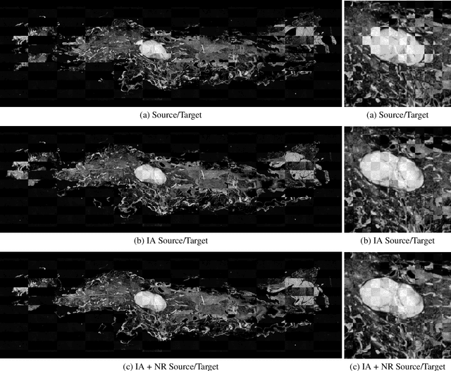 Figure 2 for Automatic Nonrigid Histological Image Registration with Adaptive Multistep Algorithm