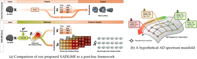 Figure 1 for XADLiME: eXplainable Alzheimer's Disease Likelihood Map Estimation via Clinically-guided Prototype Learning