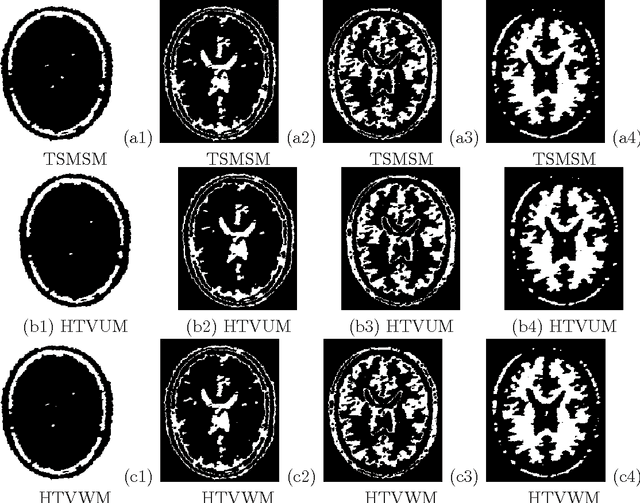 Figure 3 for Image segmentation based on the hybrid total variation model and the K-means clustering strategy