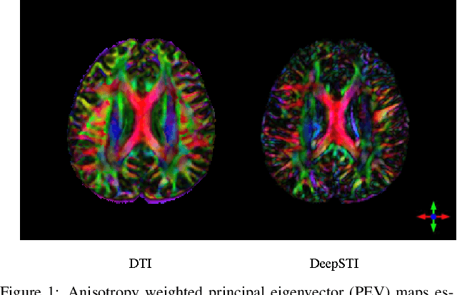 Figure 1 for DeepSTI: Towards Tensor Reconstruction using Fewer Orientations in Susceptibility Tensor Imaging