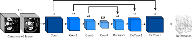 Figure 3 for Light-weight Deformable Registration using Adversarial Learning with Distilling Knowledge