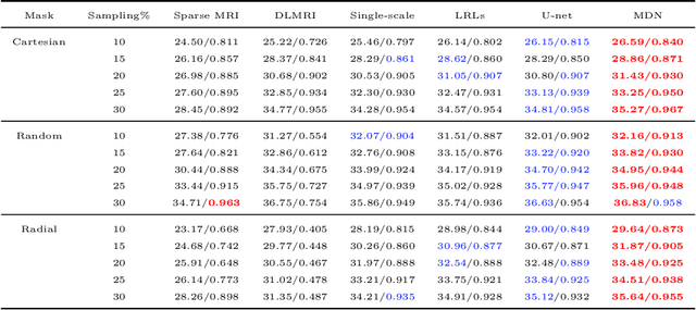 Figure 2 for Compressed Sensing MRI via a Multi-scale Dilated Residual Convolution Network