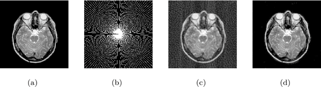 Figure 1 for Compressed Sensing MRI via a Multi-scale Dilated Residual Convolution Network