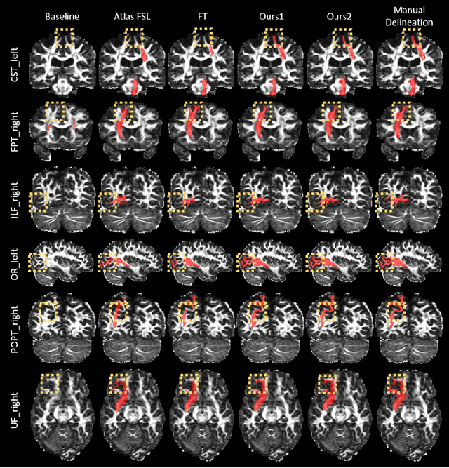 Figure 2 for Knowledge Transfer for Few-shot Segmentation of Novel White Matter Tracts