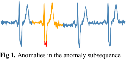 Figure 1 for Reconstruct Anomaly to Normal: Adversarial Learned and Latent Vector-constrained Autoencoder for Time-series Anomaly Detection
