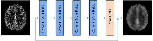 Figure 1 for Denoising Arterial Spin Labeling Cerebral Blood Flow Images Using Deep Learning