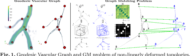 Figure 1 for Elastic Registration of Geodesic Vascular Graphs