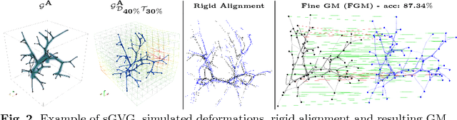 Figure 2 for Elastic Registration of Geodesic Vascular Graphs