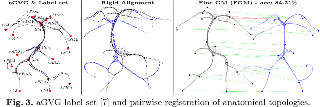 Figure 3 for Elastic Registration of Geodesic Vascular Graphs