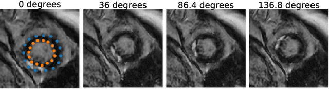 Figure 2 for Combining Multi-Sequence and Synthetic Images for Improved Segmentation of Late Gadolinium Enhancement Cardiac MRI