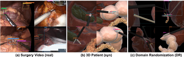 Figure 3 for hSDB-instrument: Instrument Localization Database for Laparoscopic and Robotic Surgeries