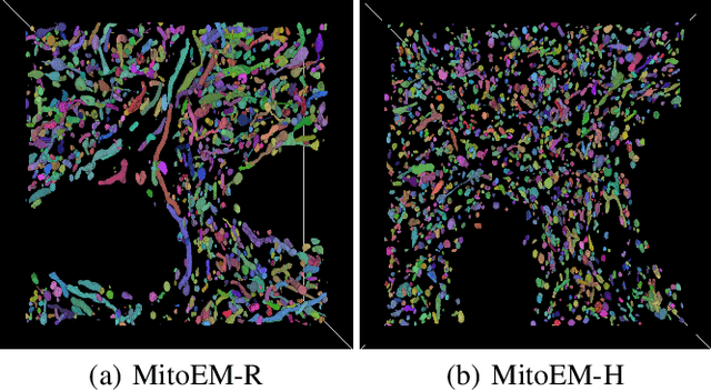 Figure 3 for Contrastive Learning for Mitochondria Segmentation