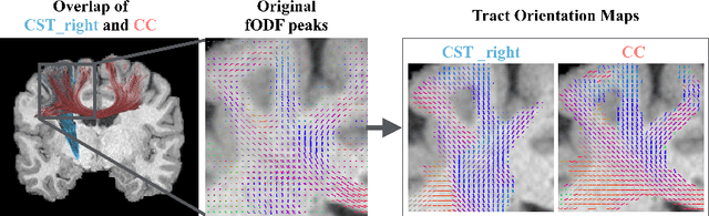 Figure 1 for Tract orientation mapping for bundle-specific tractography