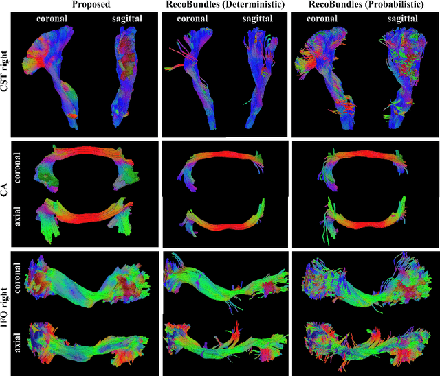 Figure 4 for Tract orientation mapping for bundle-specific tractography