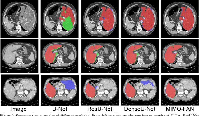 Figure 4 for Unified Multi-scale Feature Abstraction for Medical Image Segmentation