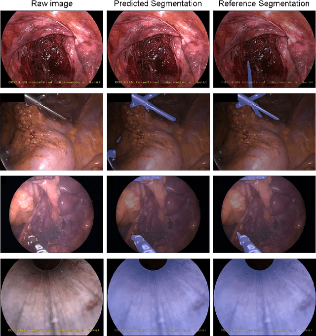Figure 2 for OR-UNet: an Optimized Robust Residual U-Net for Instrument Segmentation in Endoscopic Images
