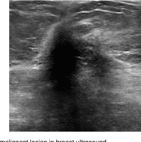Figure 1 for Automated Segmentation of Lesions in Ultrasound Using Semi-pixel-wise Cycle Generative Adversarial Nets