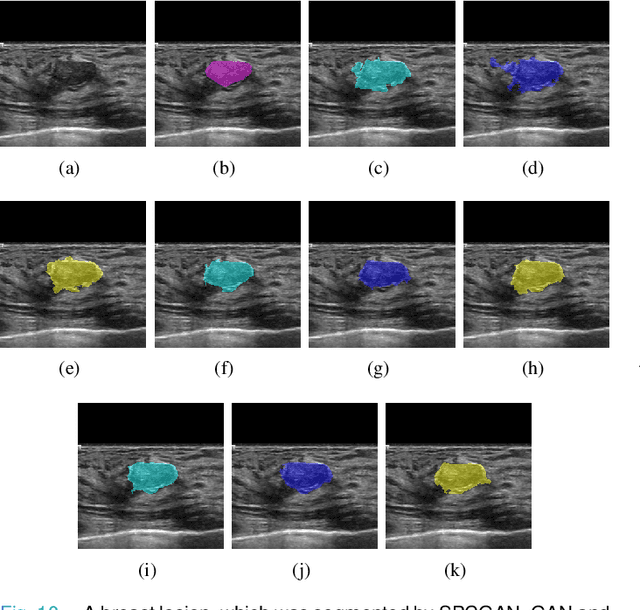 Figure 2 for Automated Segmentation of Lesions in Ultrasound Using Semi-pixel-wise Cycle Generative Adversarial Nets