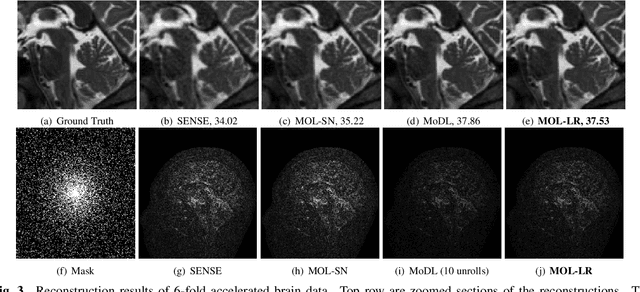 Figure 4 for Improved Model based Deep Learning using Monotone Operator Learning (MOL)