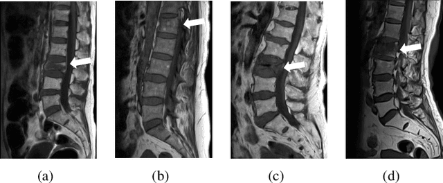 Figure 1 for Two-Stream Compare and Contrast Network for Vertebral Compression Fracture Diagnosis