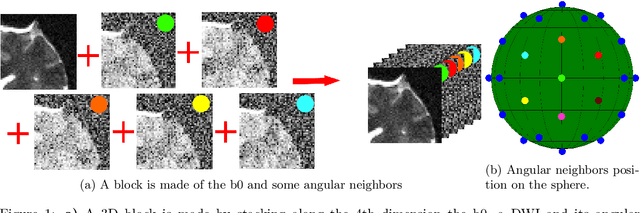 Figure 2 for Non Local Spatial and Angular Matching : Enabling higher spatial resolution diffusion MRI datasets through adaptive denoising