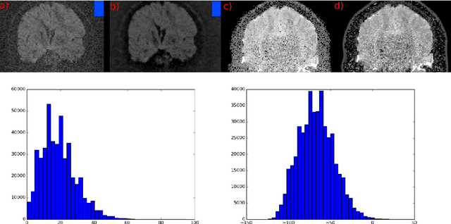 Figure 3 for Non Local Spatial and Angular Matching : Enabling higher spatial resolution diffusion MRI datasets through adaptive denoising