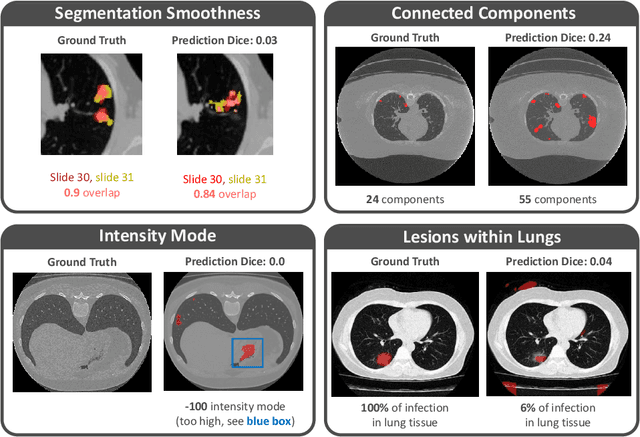 Figure 3 for Quality monitoring of federated Covid-19 lesion segmentation