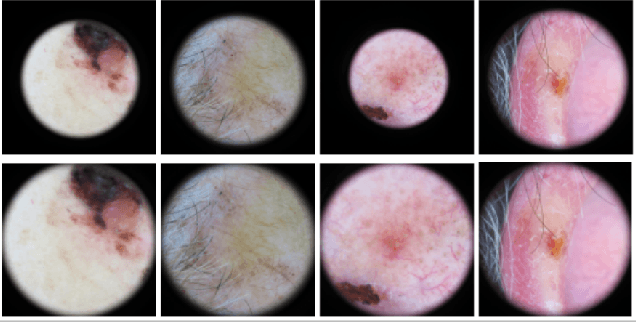 Figure 2 for Analysis of skin lesion images with deep learning