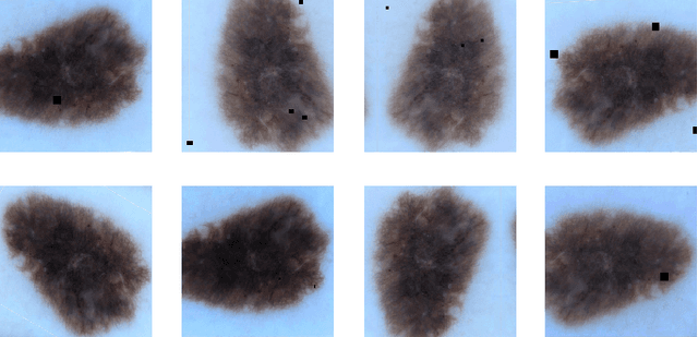 Figure 3 for Analysis of skin lesion images with deep learning