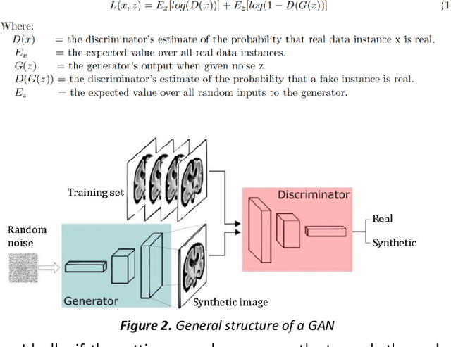 Figure 3 for Synthesis of realistic fetal MRI with conditional Generative Adversarial Networks