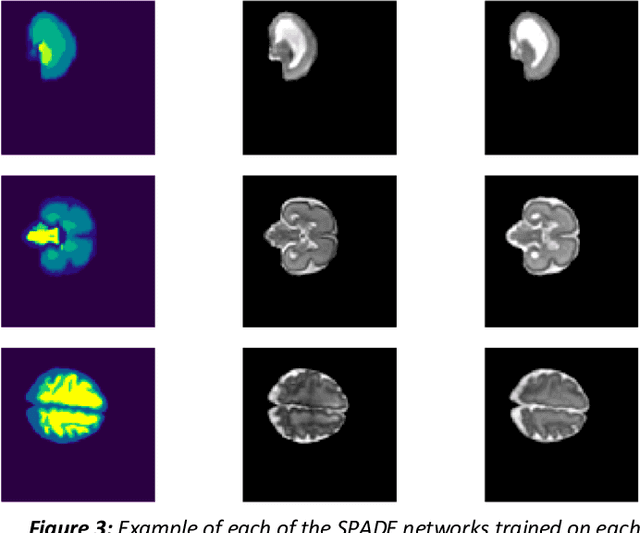 Figure 4 for Synthesis of realistic fetal MRI with conditional Generative Adversarial Networks