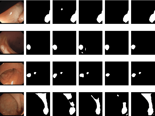 Figure 3 for Psi-Net: Shape and boundary aware joint multi-task deep network for medical image segmentation