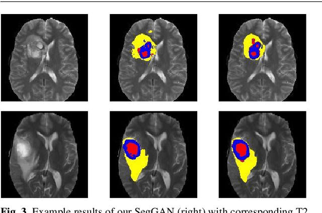 Figure 4 for SegAN: Adversarial Network with Multi-scale $L_1$ Loss for Medical Image Segmentation
